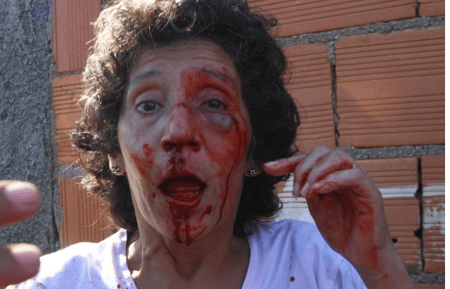 Maria da Penha mit gebrochener Nase Foto: Katia Carvalho